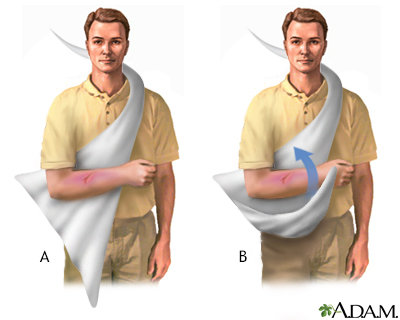 how to do a sling